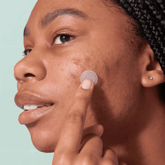 Mighty Patch™ for Early-Stage Blemishes